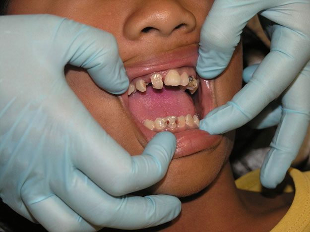 What Your Teeth Say About Your Health