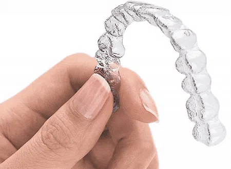 Top Benefits of Invisalign Clear Braces