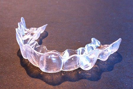 5 Facts About Clear Aligners