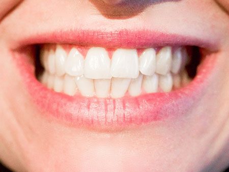 Common Myths About Teeth 1 Common Myths About Teeth