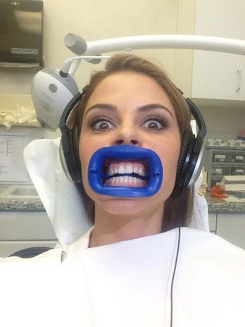 5 Facts About Teeth Whitening You Should Know